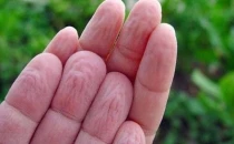 Parmaklar neden buruşur?